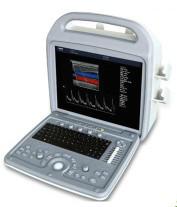 Ultrasound Scanner MYK-US101